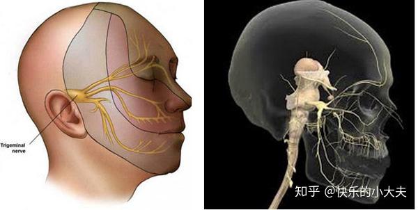 neuralgia)是最常見的腦神經疾病,以一側面部三叉神經分佈區內反覆