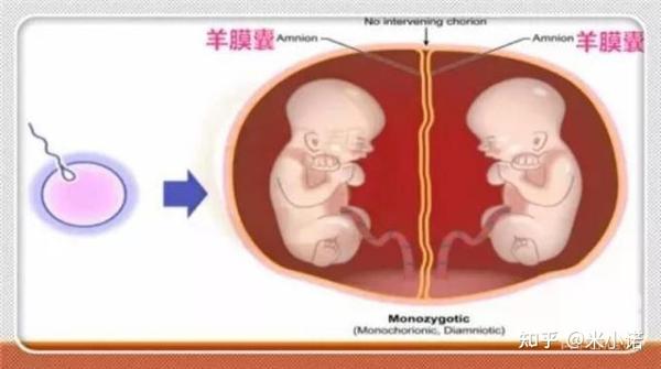 双绒双羊 单绒双羊 单绒单羊双胎 别再傻傻分不清 知乎