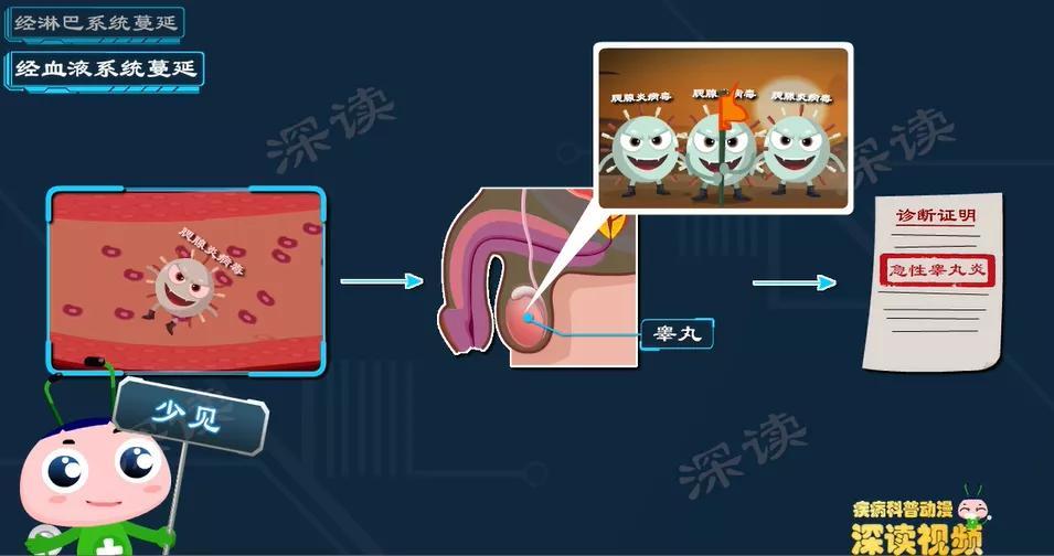 急性睪丸炎怎麼預防注意防護很多病原體是通過性傳播進入尿道,最終