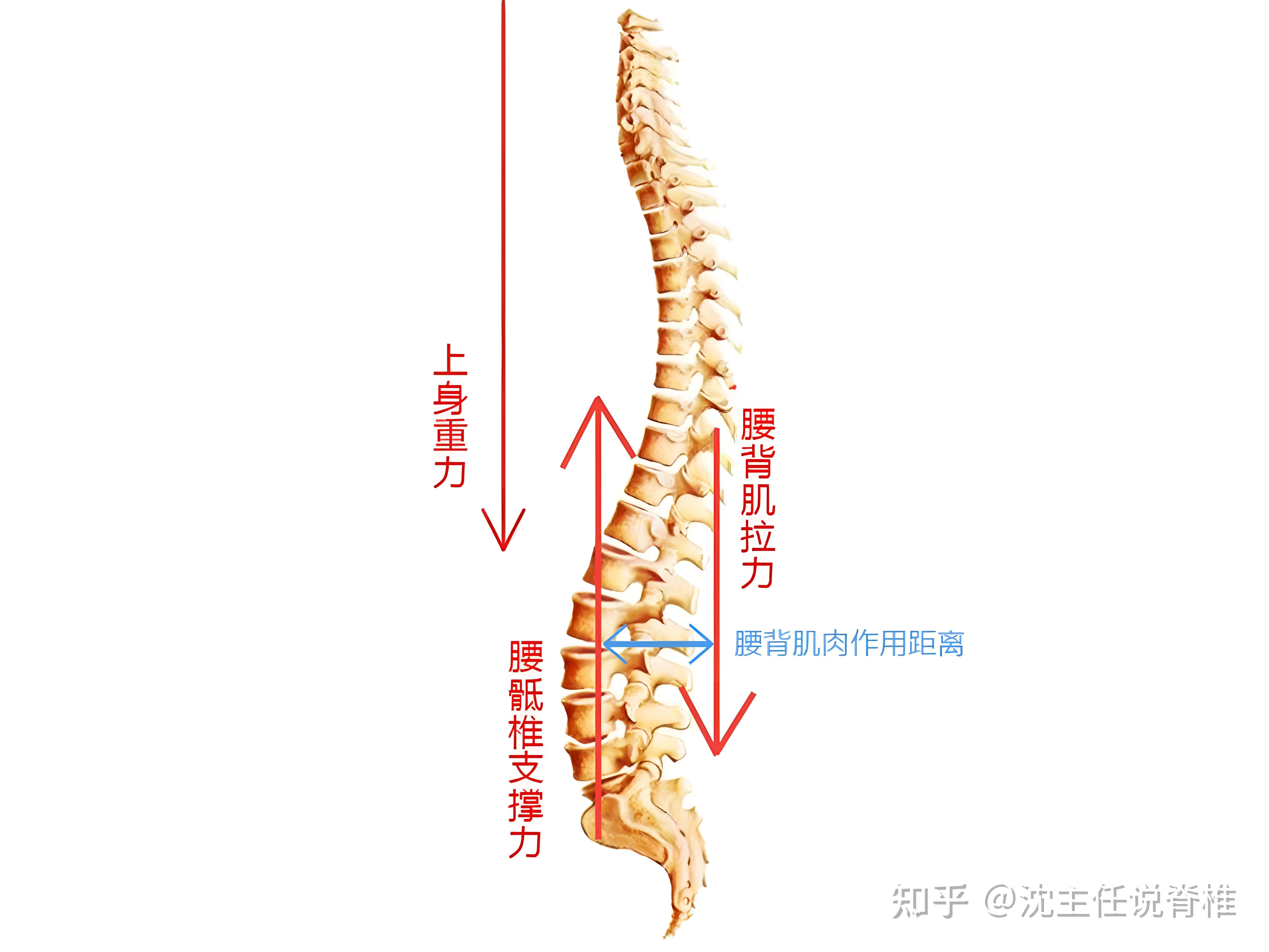 腰椎的生理弯曲结构,是由腰椎间盘前高后低的楔形形状造就的,是个非常