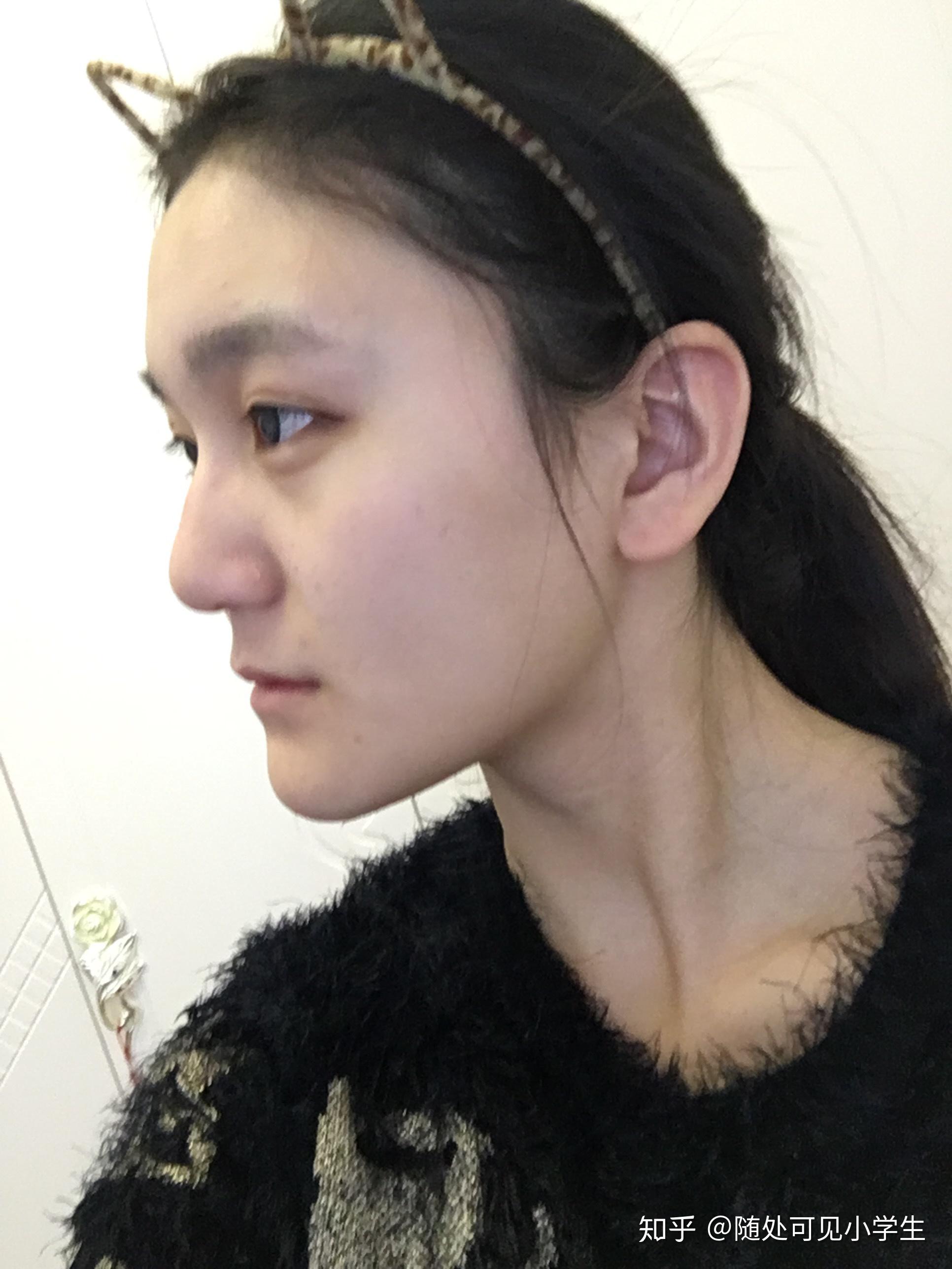 侧脸丑而正脸好看是一种什么体验?