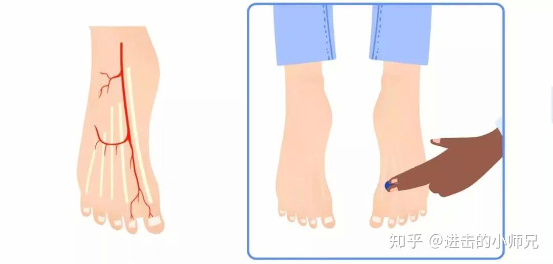 足背动脉博动点:足背动脉搏动点位于足背最高处,踇长伸肌腱与趾长伸