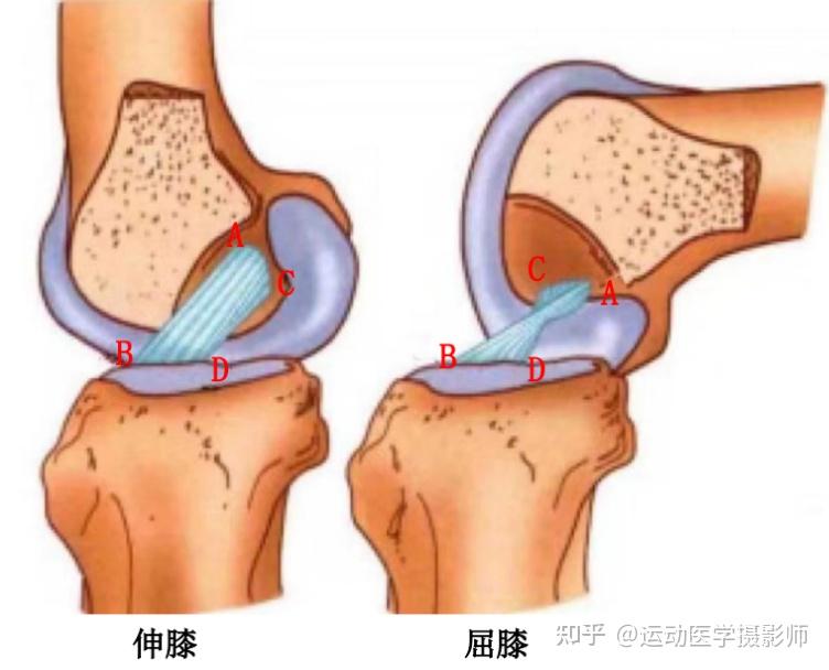 前交叉韧带损伤,一篇总结得很到位! - 知乎