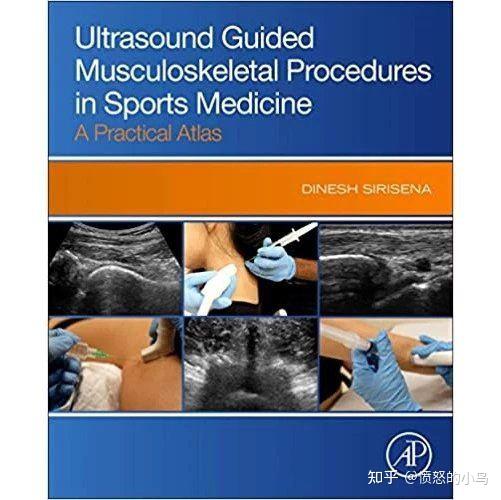 Ultrasound Guided Musculoskeletal Procedures in Sports Medicine 2021运动