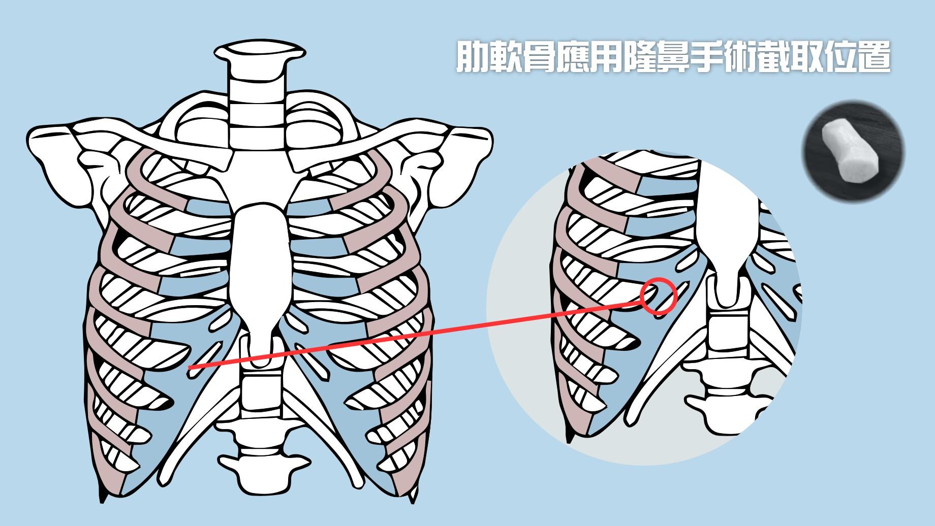 吴志贤医生帮你撑起你的面子