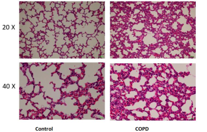慢性阻塞性肺病(COPD)小鼠模型的建模方法 - 知乎