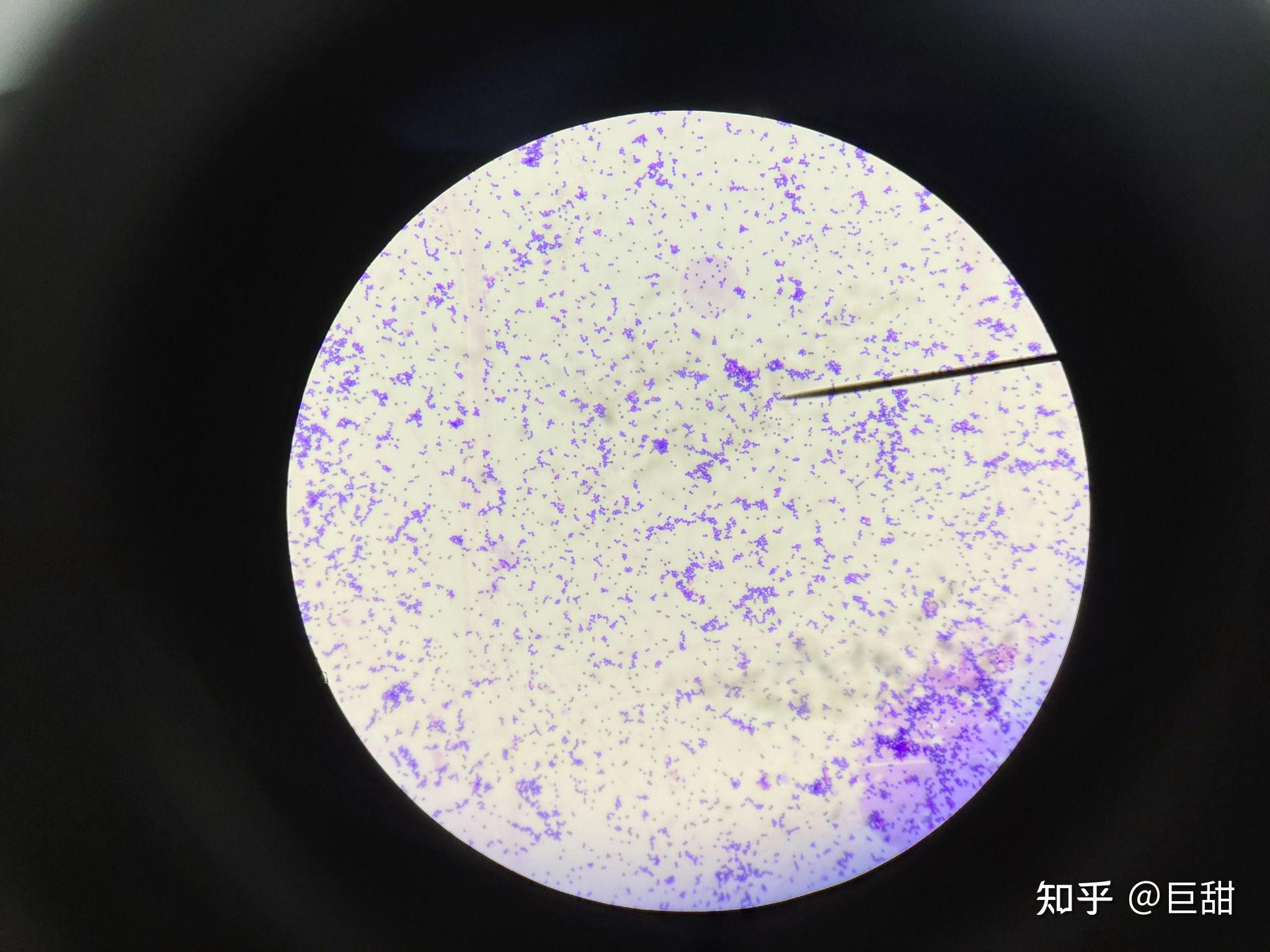 革兰氏染色大肠杆菌和金葡菌