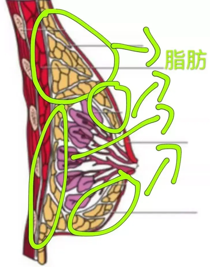 有什么方法可以减胸 v2-8fe5c7bd02b97a6356e9624346c2674b_r.jpg