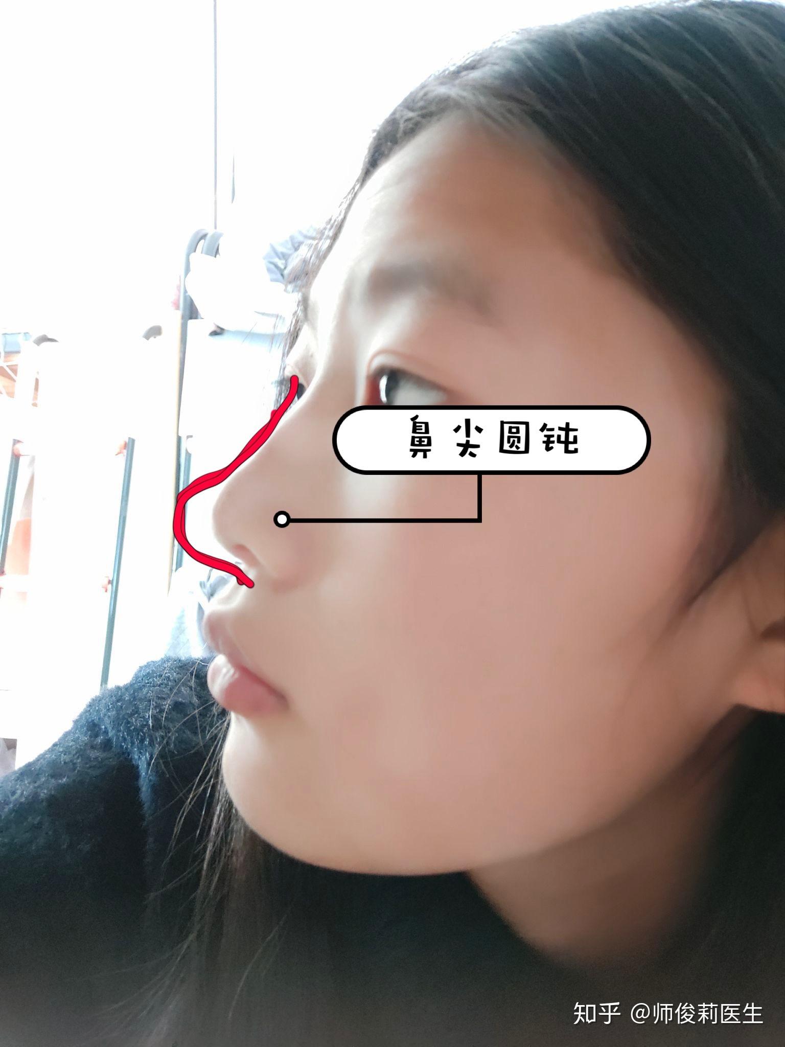 v2-8ff6402b01279128ad09dde69f3e580b_r.jpg