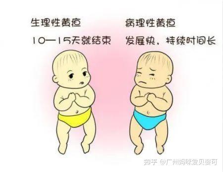 生理性黄疸?病理性黄疸?教你怎么判断 - 知乎