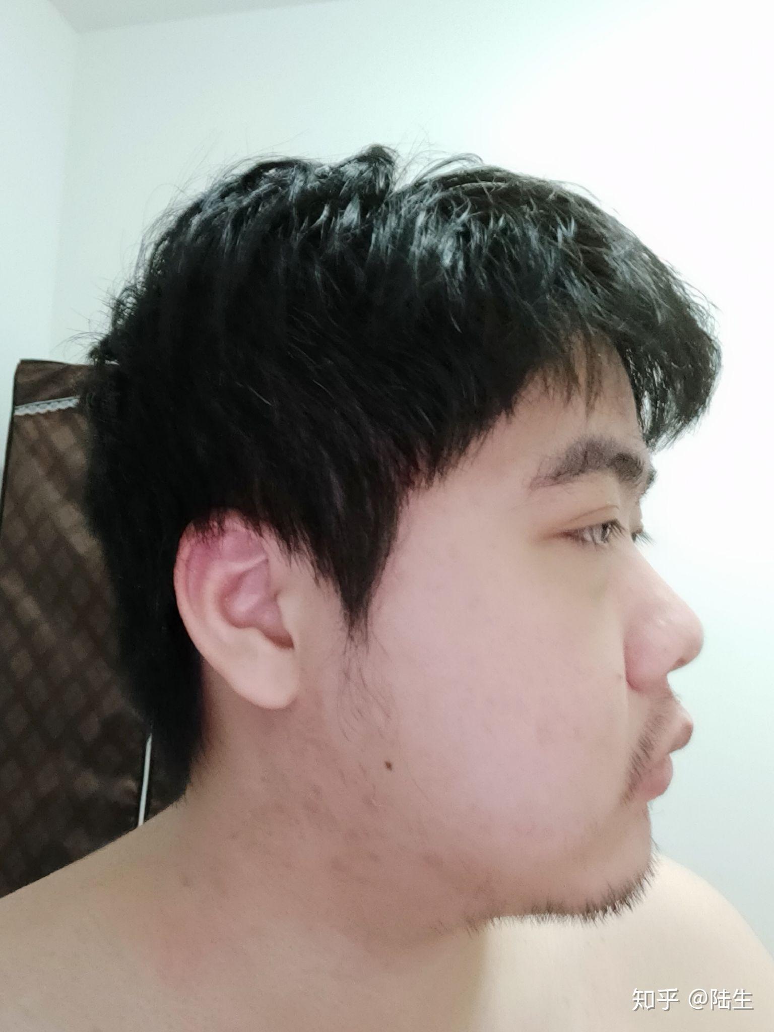 鼻子高但是山根低是什么样