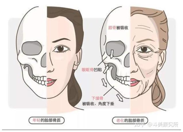 面颊凹陷的原因是什么?如何才能有效改善 - 知乎