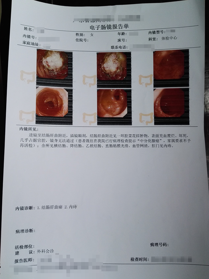 郭某某升结肠癌术后个性化指导