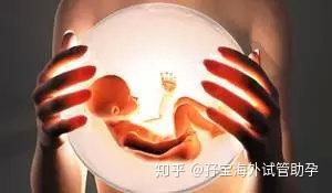 做试管婴儿前期检查需要空腹吗