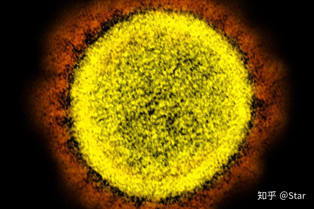 5人感染萨斯2新冠病毒2次疫苗抗体有何用