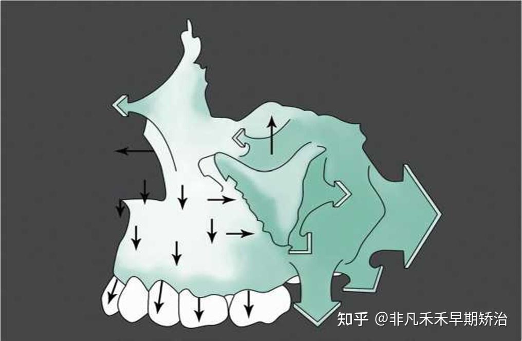 『早期矫治』早矫医生应该知道的事儿:出生后颅面部的生长发育——前颅底与颌骨的生长 - 知乎