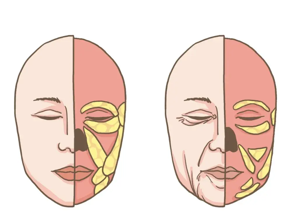 人到中年发腮问题如何有效解决