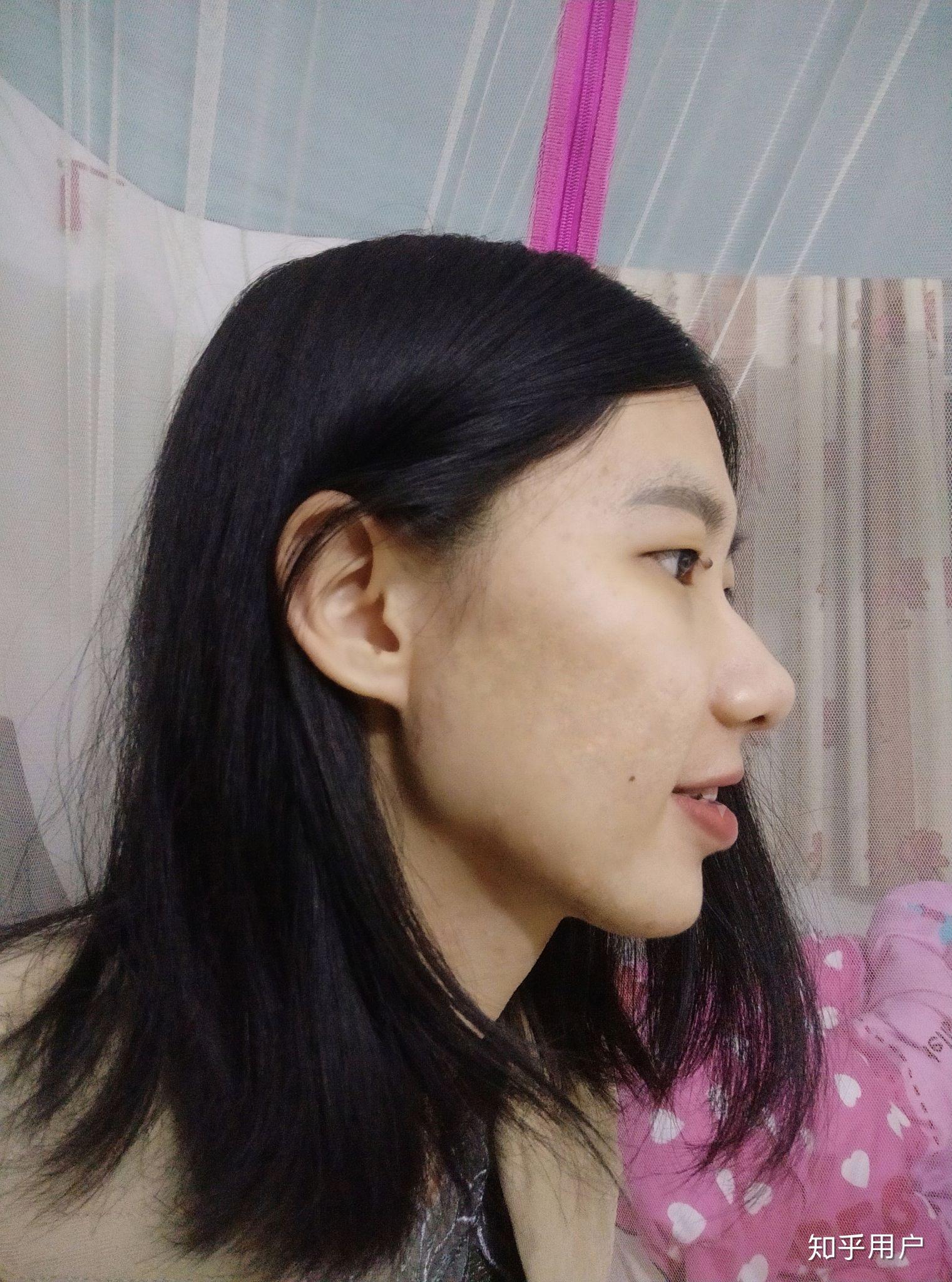 鼻子高但是山根低是什么样? - 知乎