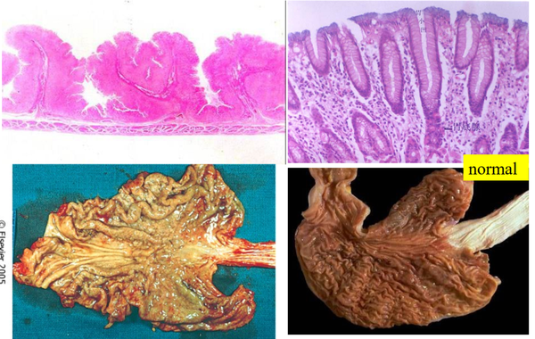 マヌカハニーを入れた緑茶を飲む