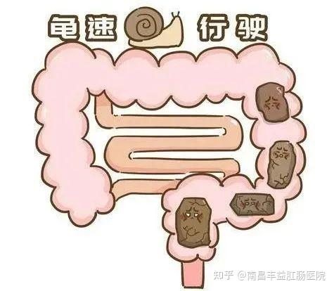 泻药不可靠,排便还需自身努力!长期使用泻药会又哪些危害,你知道吗? - 知乎