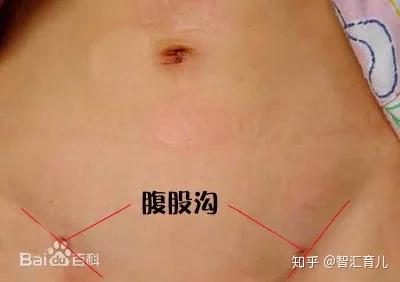 夏季孩子常中暑 该如何及时解救 知乎