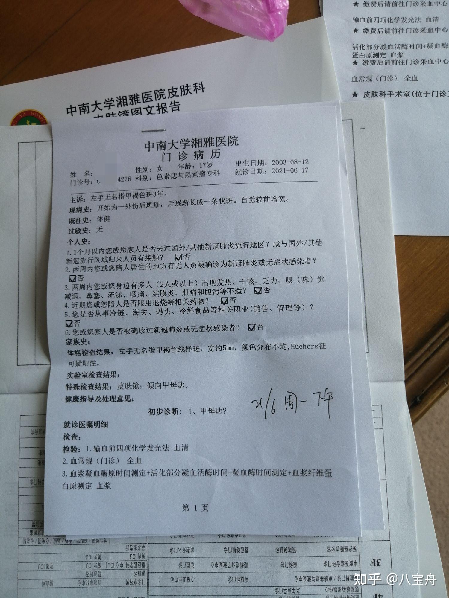 关于甲母痣手术