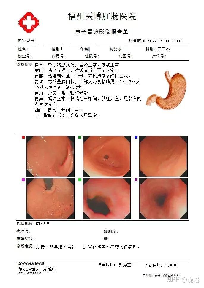 胃镜能看到咽喉吗图片