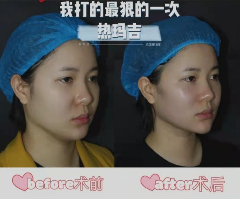 医美做完就好了?如何实现医美项目的最佳效果? - 知乎
