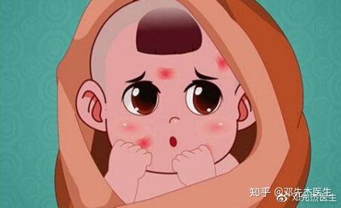 妈妈必看 宝宝身上的 红胎记 怎么办 知乎