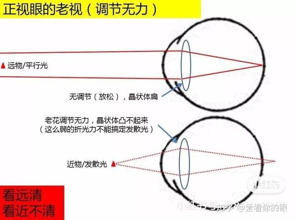 40岁以上的人都该知道！老花眼专辑（一）: 认识"老花眼" - 知乎
