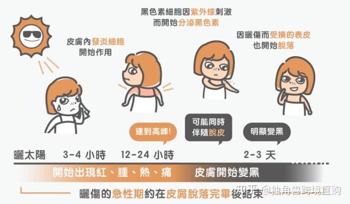 皮肤越白越容易晒伤,皮肤黑反而不会晒伤,这是什么原理? - 知乎
