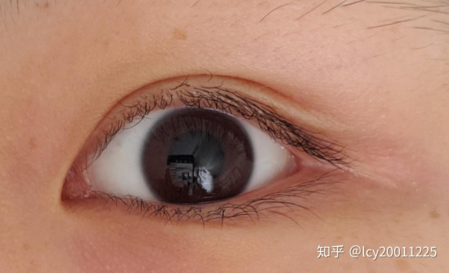 什么是双睫症?身边有这样的朋友吗? - 知乎