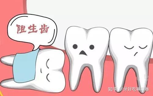 一个月的工资够你拔几颗智齿 知乎