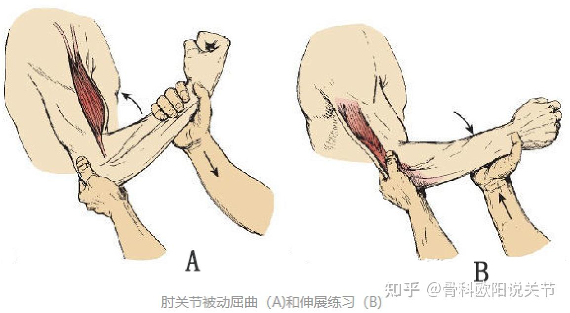 人体屈肘动作示意图图片