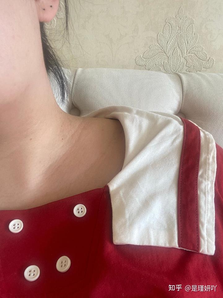 因为肥胖导致脖子黑怎么办?