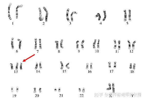 g顯帶染色體核型分析技術是細胞遺傳學檢測染色體非整倍體,多倍體