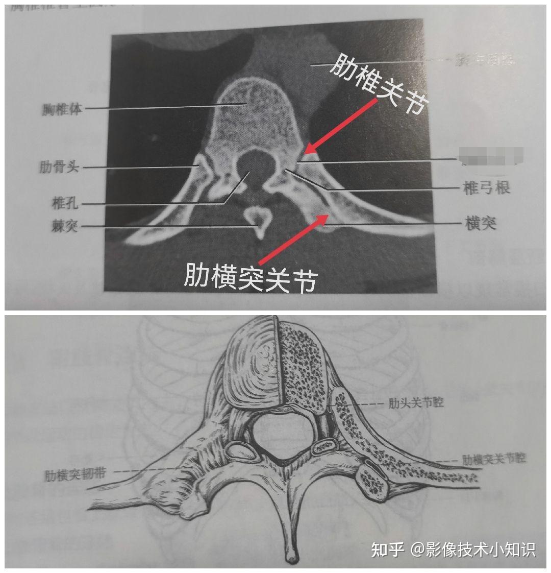 锥体钩图片