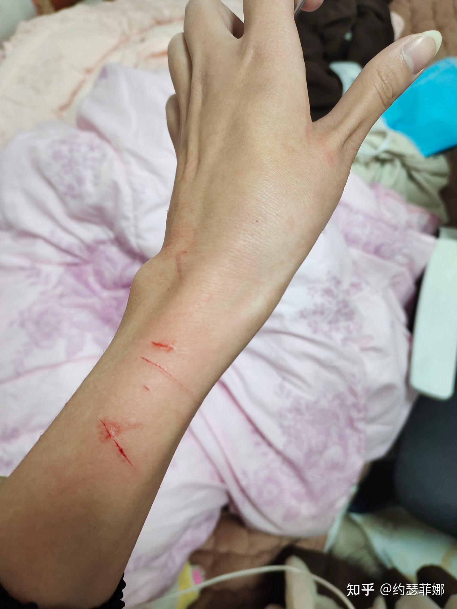 养了三年多的猫还是碰不得一碰她就抓我咬我下死手的那种我应该怎么办