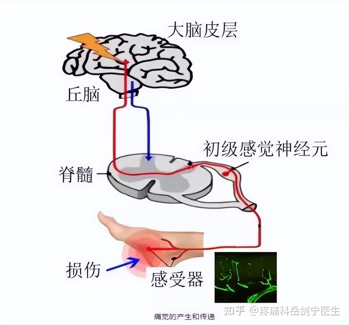 神经阻滞疗法——疼痛患者福音! - 知乎
