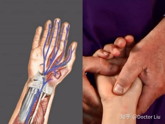 mediannerve正中神经松动