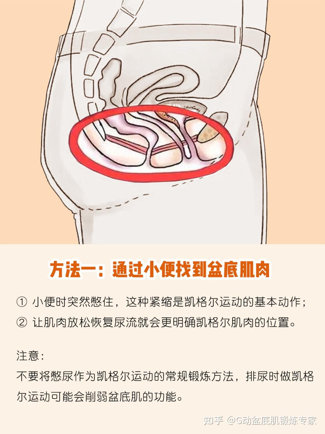 孕期产后修复准妈必做凯格尔运动详解