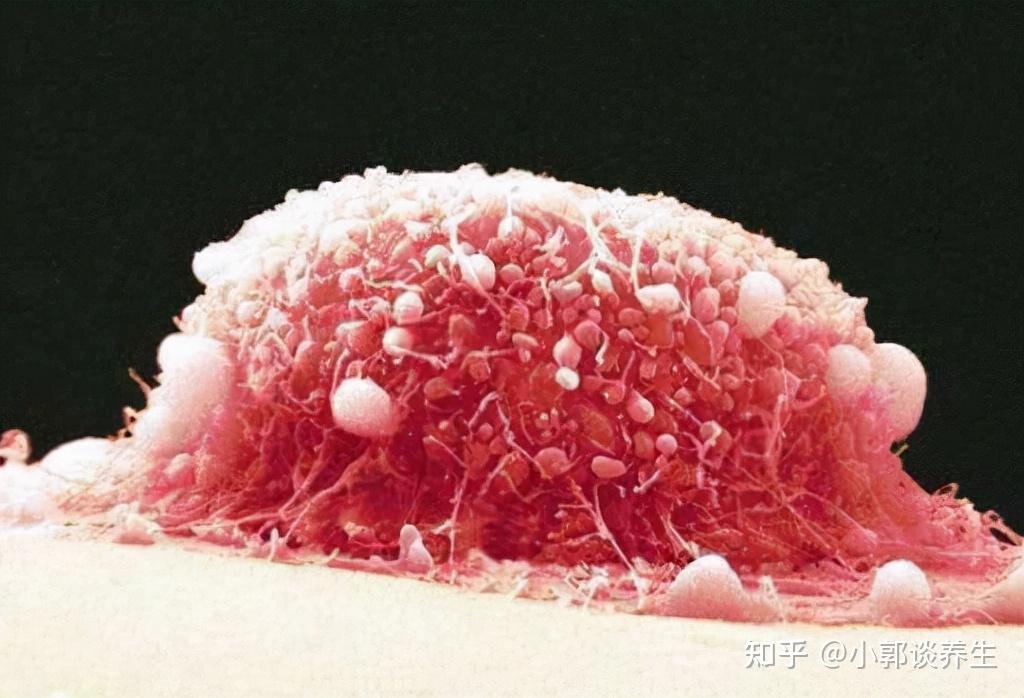 白带异常增多,不规则出血等情况之外,宫颈出现问题,感染hpv,身体还会