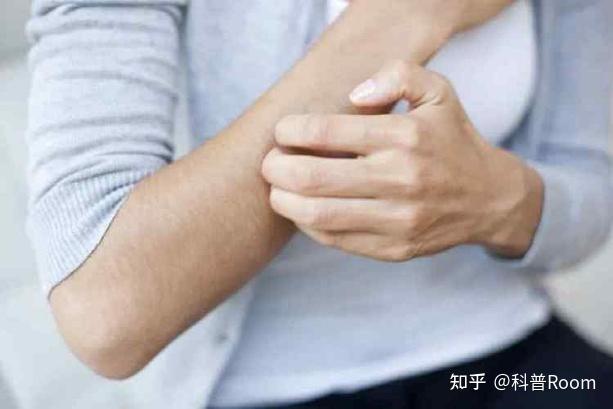 人为什么会感觉痒?“痒”感从何而来? - 知乎