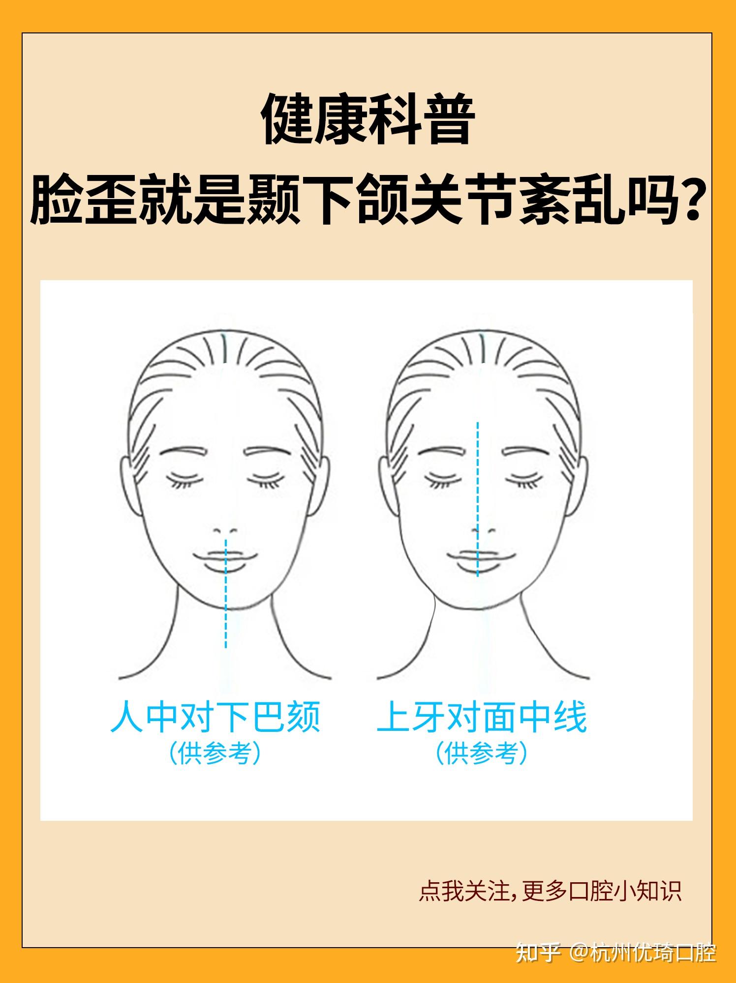 健康科普·脸歪就是颞下颌关节紊乱吗？ 知乎 