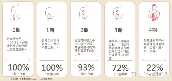 乳腺癌晚期实战生存知识 请收藏 知乎