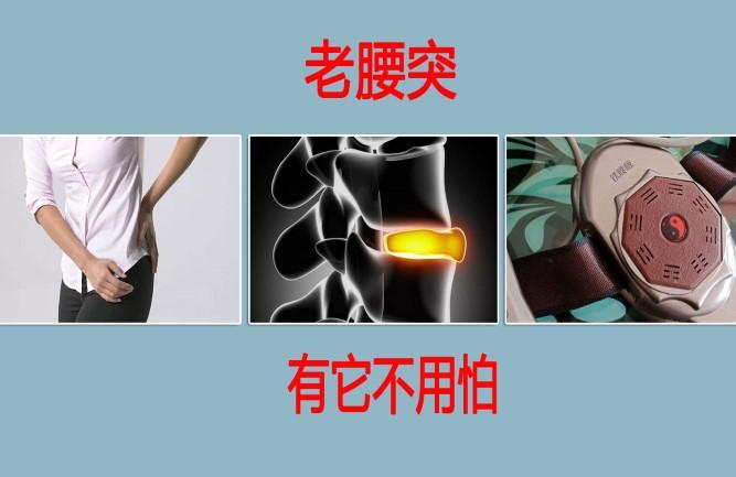 铁腰板治疗腰间盘突出优缺点 知乎