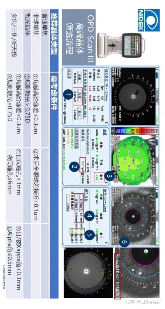眼科OPD怎么读图希玛眼科医院再添“利器”助力屈光性白内障手术_https://www.jmylbn.com_新闻资讯_第2张