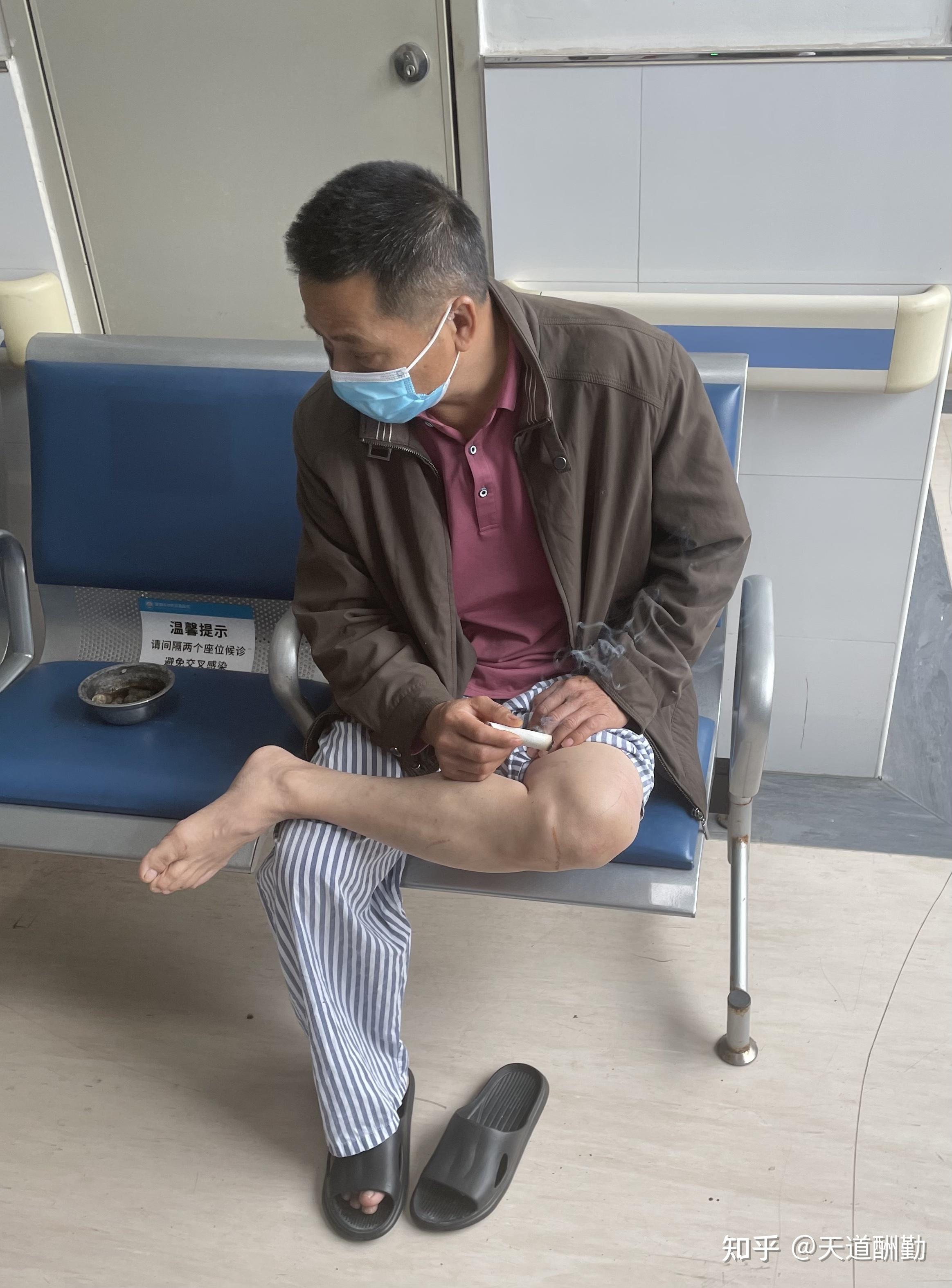 32岁,程序员,深圳痔疮手术的真实经历(四)!