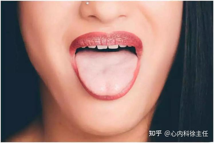 从舌头来看心脏问题,6大舌象,警惕心梗 - 知乎
