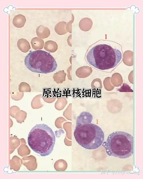 炎症-基础病理知识 - 知乎